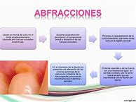 Image result for ariestramiento