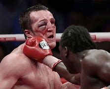 Image result for Beat Up Eye