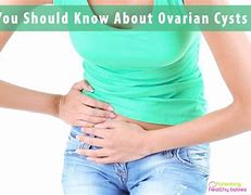 Image result for 8 Cm Ovarian Cyst