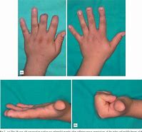Image result for Toe Hand Tablet