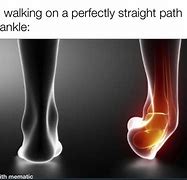 Image result for Soar Ankle Memes