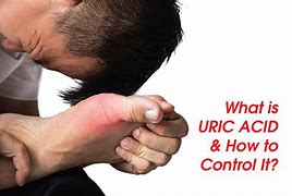 Image result for uric