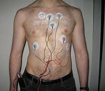 Image result for Philips Heart Monitor Patch