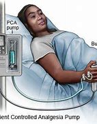 Image result for Patient-Controlled Analgesia Pump