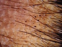 Image result for Vellus Hair Histology