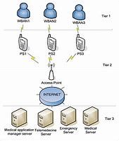 Image result for Wide Body Area Network
