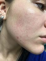 Image result for Dotted Skin