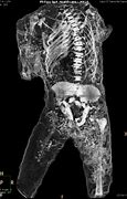 Image result for Mummies of Pompeii