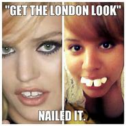 Image result for London Look Teeth