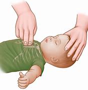 Image result for Recover After CPR