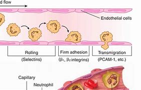 Image result for Acute Inflammation Process