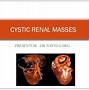 Image result for Kidney Cyst Size Chart in mm