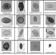 Image result for Parasite Chart