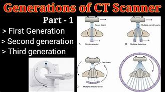 Image result for CT Scanner Diagram Generation 5th