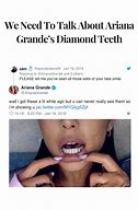 Image result for Ariana Grande Wisdom Teeth