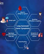 Image result for Carcinoid Tumor Symptoms