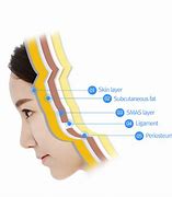 Image result for Smas Face Anatomy