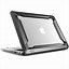 Image result for MacBook Air Rugged Case