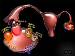 Image result for Involuting Ovarian Cyst Ultrasound