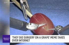 Image result for Surgery On a Grape Meme