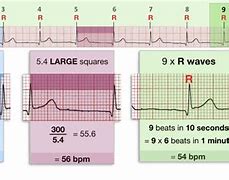 Image result for 10 Second Heart Rate Chart