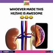 Image result for Kidney Stealing Meme