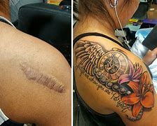 Image result for Don't Turn Your Back On Me Scar Tattoo