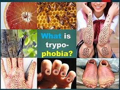 Image result for Trypophobia Feet