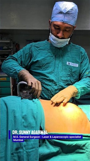 Laparoscopic Umbilical Hernia Repair Surgery - Dr. Sunny Agarwal