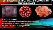 CONDYLOMA ACUMINATUM AND COMMON HPV RELATED LESIONS. BY Dr. WAFAEY BADAWY