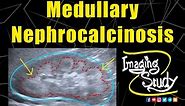 Medullary Nephrocalcinosis || Ultrasound || Case 128