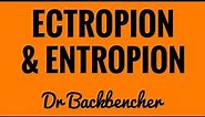 Ectropion and Entropion - causes, symptoms, types and treatment - Ophthalmology