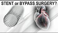 Stent or Bypass Surgery?
