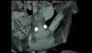 Wahlberg's epauletted fruit bat and his peculiar call -- No Music, only sound