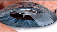 Watch live surgery using the laser cataract system - how does it work? Eye News TV