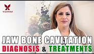 How Do We Diagnose Jawbone Cavitation and Treatment Options