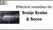 Scabs & Sores on Scalp: Treatment, Causes & Remedies - Dr. Aruna Prasad