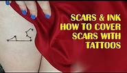 Scars & Ink ►How to Cover Scars with Tattoos