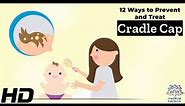 Cradle Cap Solutions: 12 Effective Ways to Prevent and Treat It