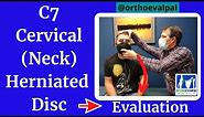 C7 Cervical (neck) Herniated Disc Evaluation