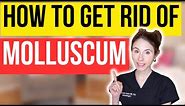 How To Get Rid Of Molluscum FAST | Dermatologist Tips