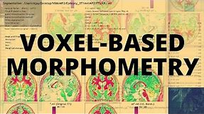 Voxel-based Morphometry (VBM)