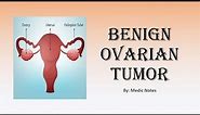 [O&G] Benign ovarian tumor - classification, clinical features, investigation, treatment