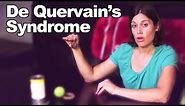 De Quervain's Syndrome Stretches, aka Blackberry Thumb - Ask Doctor Jo