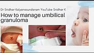 What is an umbilical granuloma? How do we manage the umbilical granuloma? #umbilicalgranuloma