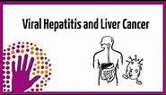 Viral Hepatitis and Liver Cancer