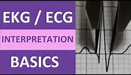 EKG/ECG Interpretation Basics Nursing NCLEX | QRS Complex, P Wave, T Wave, PR Interval