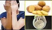 Skin Whitening Potato Facial Bleach | Get Fair, Spotless, Glowing Skin at Home
