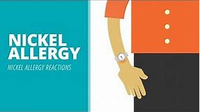 Nickel allergy – nickel allergic reactions