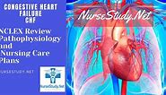 Congestive Heart Failure (CHF) Nursing Diagnosis and Care Plan - NurseStudy.Net